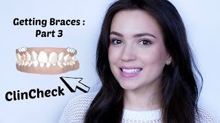 Getting Braces  Part 3  ClinCheck [upl. by Frendel495]