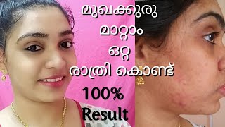 ഒറ്റ രാത്രി കൊണ്ട് മുഖക്കുരു മാറ്റാം  Remove pimple overnight  Aloe vera face pack Acne treatment [upl. by Paulette]