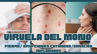 VIRUELA DEL MONO 🐵 Erupciones cutáneas fiebre ganglios ALERTA EPIDEMIOLÓGICA 📢 [upl. by Sallyanne]