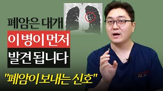 건강검진에서 폐결절이 나왔는데 어떡하나요 [upl. by Tloh]