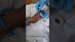 IV cannula insertion theprettynurse nursingofficer healthcareprofessionals medicalprofession [upl. by Scotti204]