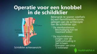 Knobbel in de schildklier [upl. by Nefets]