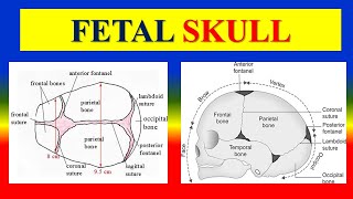 FETAL SKULL  Bones Regions Landmarks amp sutures fontanelles diameters amp Moulding  OBG [upl. by Oyek]