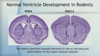 Developmental Neurotoxicity of Ultrafine Particles Parallels with Neurodevelopmental Disorders [upl. by Bautista]