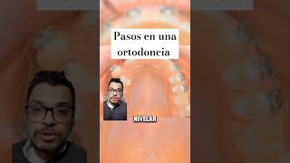 ORTODONCIA Expansor del Paladar odontologia [upl. by Nodnahs]