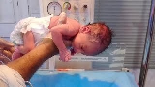 New born baby very premature and low birth wieght and iugr but baby is active take oral weigt 21lbs [upl. by Ahsinrad]