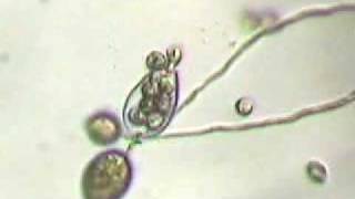 Phytophthora ramorum in action [upl. by Maier]