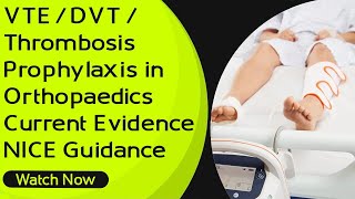 VTE  DVT Thrombosis Prophylaxis in Orthopaedics  Current Evidence  NICE Guidance [upl. by Gabey943]