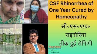 CSF Rhinorrhea of One Year Cured by Homeopathy [upl. by Suzan944]