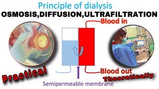 Principle of Hemodialysis  How Dialysis Works [upl. by Solana]