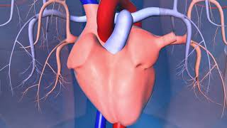 Implantable CardioverterDefibrillator ICD [upl. by Lleinnad]