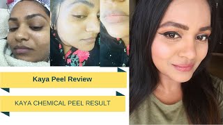 Kaya Skin Peel Treatment ReviewKaya Peel ExperienceChemical Peel India [upl. by Lledniw]