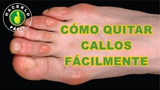 Cómo Quitar Callos de los Pies Fácilmente y Sin Dolor  Hacerlo Fácil [upl. by Vullo]