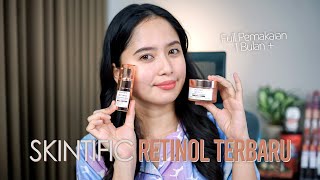 Review Retinol SKINTIFIC selama 1 BULAN   SKINTIFIC Retinol Skin Renewal [upl. by Guinevere]