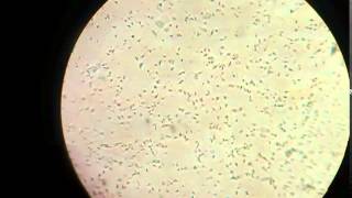 Sperm cells in microscope [upl. by Ches954]