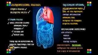 NCLEX Review on the Gastro Diseases Chrons Ulcerative [upl. by Culley]