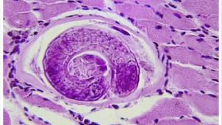 Trichinella spiralis Trichinosis 2  HEALTH EDUCATION  INFECTION CONTROL ICSP  URDU  HINDI [upl. by Mansur256]