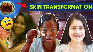 😱 एक बार ये लगा लो चेहरे से मैल कि सारी काली परत हट जाएगी RemoveTan Dark Sports Pigmentation [upl. by Notnek]