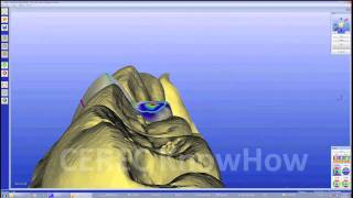 CEREC® Crown Biogeneric Reference  Crown  Software [upl. by Nicolau641]