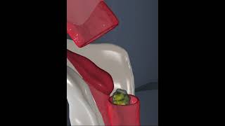 Human Digestive system Epiglottis 3D Animation [upl. by Nosyarg630]