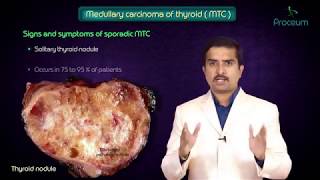 Thyroid neoplasms part 3  Medullary carcinoma of thyroid   Endocrine pathology [upl. by Efrem807]