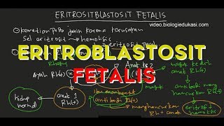 Eritroblastosis Fetalis Akibat Perbedaan Rhesus Darah [upl. by Ahsiekat]