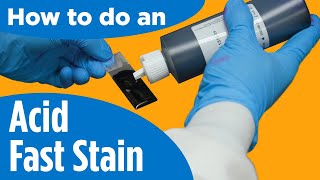 How to do an AcidFast Stain  Instructions for the labprocedure [upl. by Anoiek]