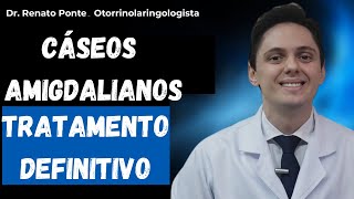 👨‍⚕️Já teve essas bolinhas fedidas na garganta também conhecidas como cáseos amigdalianos [upl. by Aileahcim]