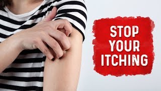 What Causes Hives and Itchiness  Urticaria Hives Treatment  Dr Berg [upl. by Bolte58]