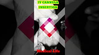 IV CANNULA INSERTION 🩺💉🩺💉🩺💉💉💉💉💉🩺💉cannula youtubeshorts shortshospital viral medicarenurshing [upl. by Ahsoem]