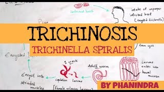 TRICHINOSIS  TRICHINELLA SPIRALIS  STRUCTURE  LIFE CYCLE  SYMPTOMS  BY PHANINDRA GUPTA [upl. by Atnwahs]