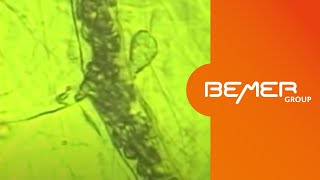 The BEMER Effect  microscopic demonstration of the effect on microcirculation  EN [upl. by Atteragram]