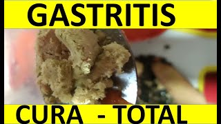 Cura Gastritis  Ulcera gástrica  Colo Irritable y Colitis [upl. by Verne]