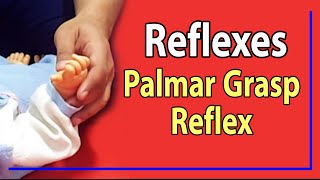 21 Palmar Grasp Reflex [upl. by Monsour]