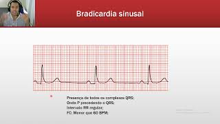 Taquiarritmias e Bradiarritmias [upl. by Ellenwahs]
