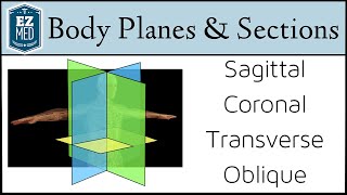 EASY TRICKS for Anatomical Body Planes and Sections DirectionPosition [upl. by Langbehn]