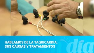 Hablamos de la taquicardia sus causas y tratamientos [upl. by Palmira]