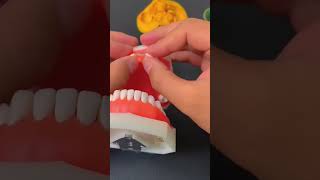 A Comprehensive Guide to Using Tooth Repair Kits Effectively youtubeshorts [upl. by Ennovyhs506]