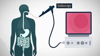 MiGUT  An ingestible device for gastric electrophysiology [upl. by Fihsak]