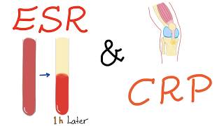 ESR and CRP [upl. by Ahserkal154]