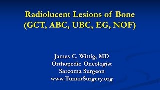 Orthopedic Oncology Course  Radiolucent Lesions of Bone GCT ABC UBC  Lecture 7 [upl. by Alarice905]