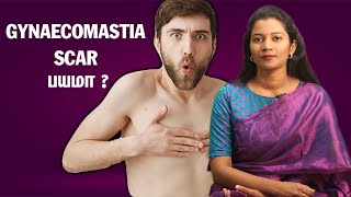 Gynaecomastia Scar பயமா   DrCharumathy Explains [upl. by Fisa304]