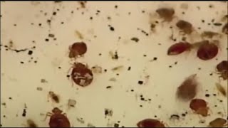 Bed bug cases are on the rise  How to spot bed bugs the next time you travel [upl. by Cleti]