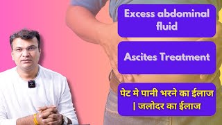 Excess abdominal fluid  Ascites Treatment  पेट मे पानी भरने का ईलाज  जलोदर का ईलाज [upl. by Atinna700]