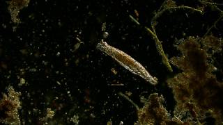 🔬 rotifer  offaxis illumination of microorganism in pond water under microscope 4K [upl. by Chandos826]