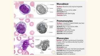 Medical Haematology  Monocyte maturation series monoblast vs promonocyte vs monocyte [upl. by Aarika228]