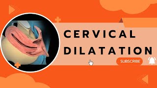 Cervical Dilatation [upl. by Lrak]