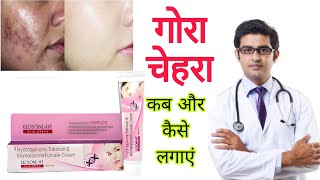 Elesone HT skin Cream HONEST review 2024 In Hindi  Elesone HT Cream results benefits price info [upl. by Dawes538]