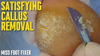 Satisfying Callus Removal From Feet  Callus Removal From Feet With Blade By Miss Foot Fixer [upl. by Sundberg]