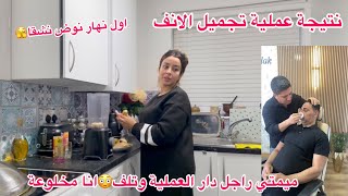 درتها لراسي🫨راجل دار عملية تجميل وتسيف وتزادت فيه ظلعة😰نتيجة الانفاول نهار نطيب بعد سفردردشة معا [upl. by Yendirb]